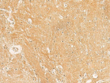Immunohistochemistry of paraffin-embedded Human brain tissue using TXNDC12 Polyclonal Antibody at dilution of 1:50(×200)