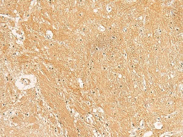 Immunohistochemistry of paraffin-embedded Human brain tissue using TXNDC12 Polyclonal Antibody at dilution of 1:50(×200)