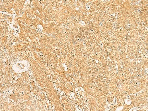 Immunohistochemistry of paraffin-embedded Human brain tissue using TXNDC12 Polyclonal Antibody at dilution of 1:50(×200)