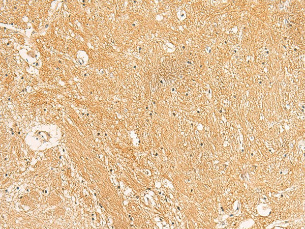Immunohistochemistry of paraffin-embedded Human brain tissue using TXNDC12 Polyclonal Antibody at dilution of 1:50(×200)