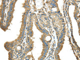 Anti-Human/Mouse/Rat NME2 Antibody - ABMIUM