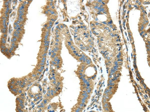 Anti-Human/Mouse/Rat NME2 Antibody - ABMIUM