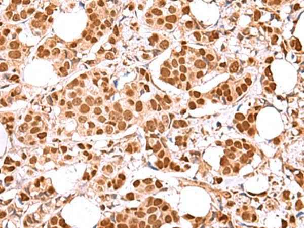 Anti-Human/Mouse RCOR3 Antibody