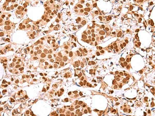 Anti-Human/Mouse RCOR3 Antibody