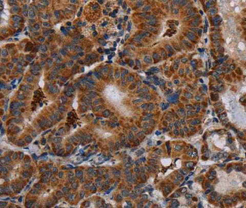 Anti-Human DISC1 Antibody