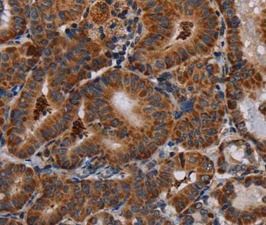 Anti-Human DISC1 Antibody