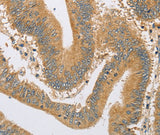 Anti-Human/Mouse/Rat ARHGEF1 Antibody - ABMIUM