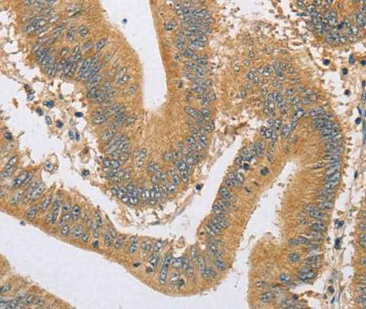 Anti-Human/Mouse/Rat ARHGEF1 Antibody