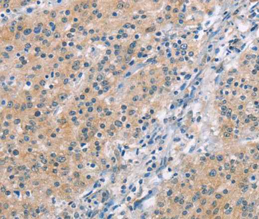 Anti-Human/Mouse/Rat MCL1 Antibody