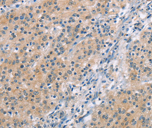 Anti-Human/Mouse/Rat MCL1 Antibody - ABMIUM