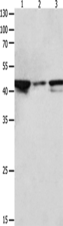 Anti-Human/Mouse/Rat MAP2K2 Antibody - ABMIUM