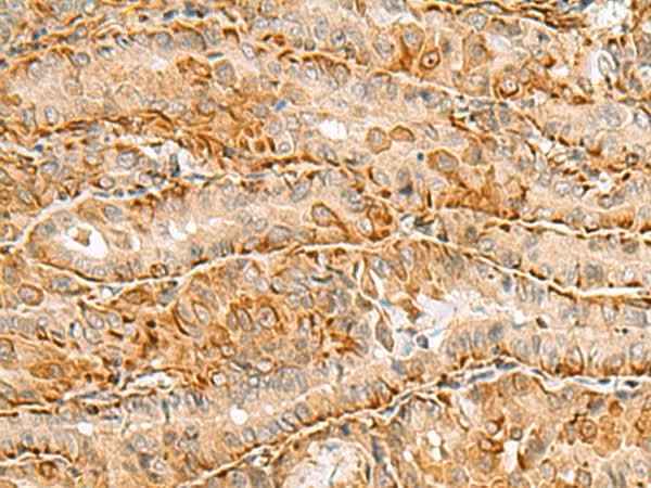 Anti-Human/Mouse/Rat C3orf38 Antibody