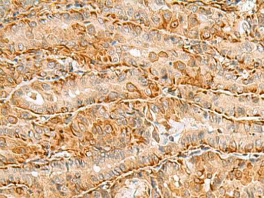 Anti-Human/Mouse/Rat C3orf38 Antibody