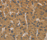 Anti-Human CYP17A1 Antibody - ABMIUM