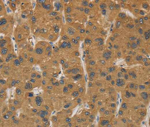 Anti-Human CYP17A1 Antibody