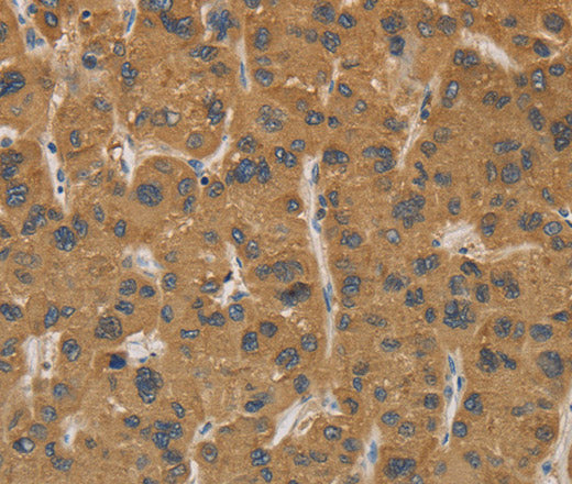 Anti-Human CYP17A1 Antibody - ABMIUM