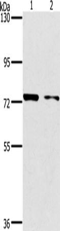 Anti-Human/Mouse PPP1R13L Antibody - ABMIUM