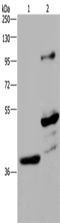 Anti-Human/Mouse/Rat GAS7 Antibody - ABMIUM