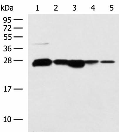 Western blot analysis of 293T HepG2 cell Human fetal liver tissue Human liver tissue TM4 cell lysates using CCDC134 Polyclonal Antibody at dilution of 1:800