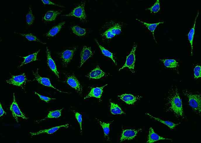 Anti-Human PDHA1 Antibody [B379] - ABMIUM