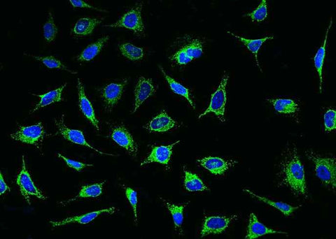 Anti-Human PDHA1 Antibody [B379] - ABMIUM