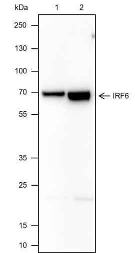 Anti-Human IRF6 Antibody [A404] - ABMIUM