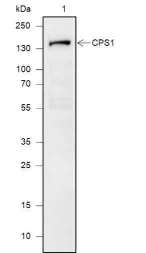 Anti-Human/Rat/Mouse CPS1 Antibody [A622] - ABMIUM