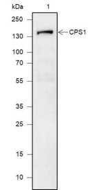 Anti-Human/Rat/Mouse CPS1 Antibody [A622]