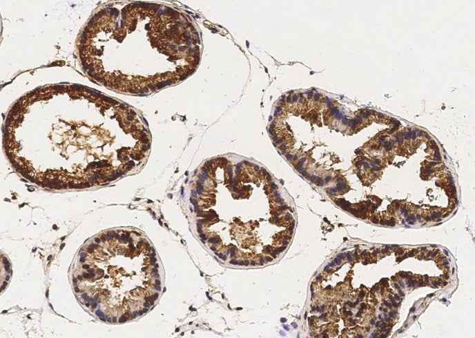 Anti-Mouse CAMK4 Antibody [B494] - ABMIUM