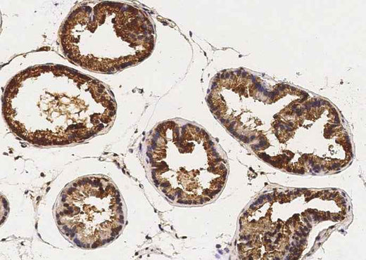 Anti-Mouse CAMK4 Antibody [B494] - ABMIUM