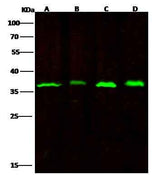 Anti-Human RPRD1B Antibody [A988] - ABMIUM