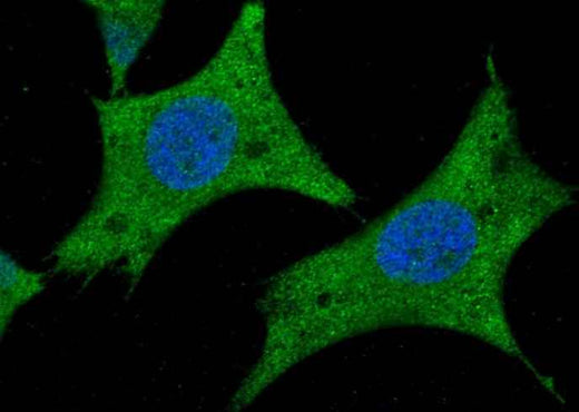 Anti-Human AARSD1 Antibody [A1276] - ABMIUM