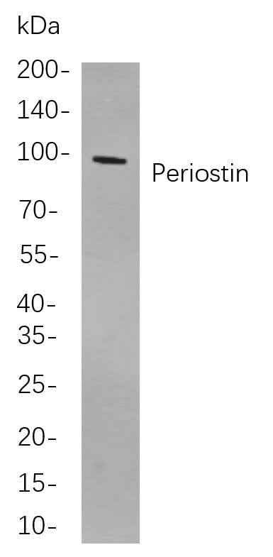 Anti-Human Periostin Antibody [B865] - ABMIUM