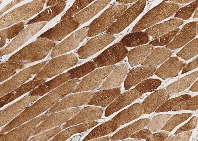 Anti-Human CKM Antibody [A1096] - ABMIUM