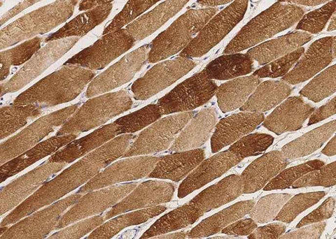 Anti-Human CKM Antibody [A1096] - ABMIUM
