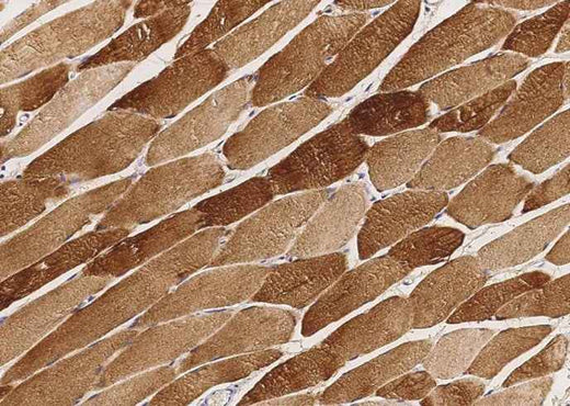 Anti-Human CKM Antibody [A1096] - ABMIUM