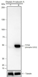 Anti-Human Phospho-PTP1B (Ser352) Antibody [A801] - ABMIUM