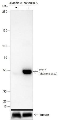Anti-Human Phospho-PTP1B (Ser352) Antibody [A801] - ABMIUM