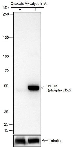 Anti-Human Phospho-PTP1B (Ser352) Antibody [A801] - ABMIUM