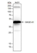 Anti-Human MAGEA1 Antibody [A293]