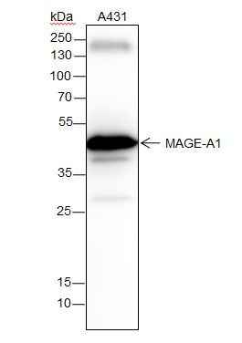 Anti-Human MAGEA1 Antibody [A293] - ABMIUM