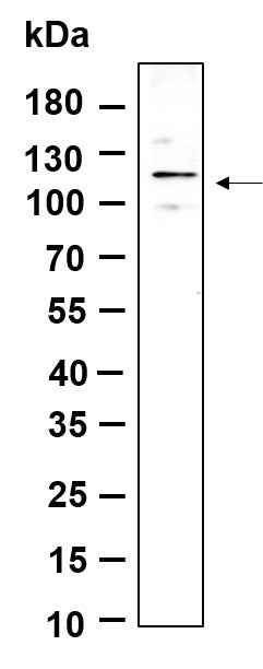 Anti-Human/Mouse/Rat FAK Antibody [B909] - ABMIUM