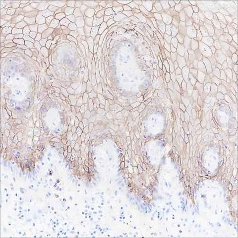 Anti-Human/Mouse CD138/Syndecan-1 Antibody [A158] - ABMIUM