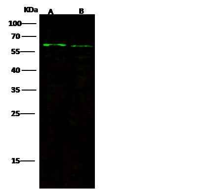 Anti-Mouse FGFRL1 Antibody [B419] - ABMIUM