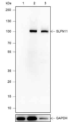 Anti-Human SLFN11 Antibody [A582] - ABMIUM