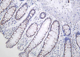 Anti-Human/Mouse/Rat AMPKβ1 Antibody [B1022]