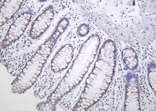Anti-Human/Mouse/Rat AMPKβ1 Antibody [B1022] - ABMIUM