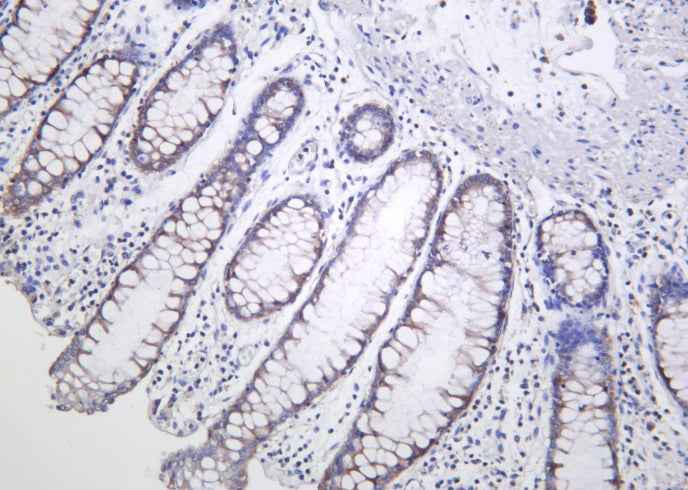 Anti-Human/Mouse/Rat AMPKβ1 Antibody [B1022]