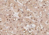 Anti-Human RPRD1B Antibody [A989] - ABMIUM