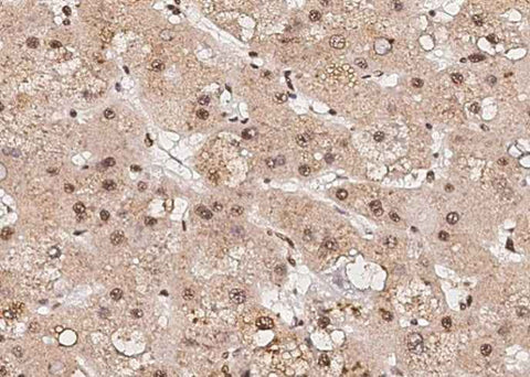Anti-Human RPRD1B Antibody [A989] - ABMIUM